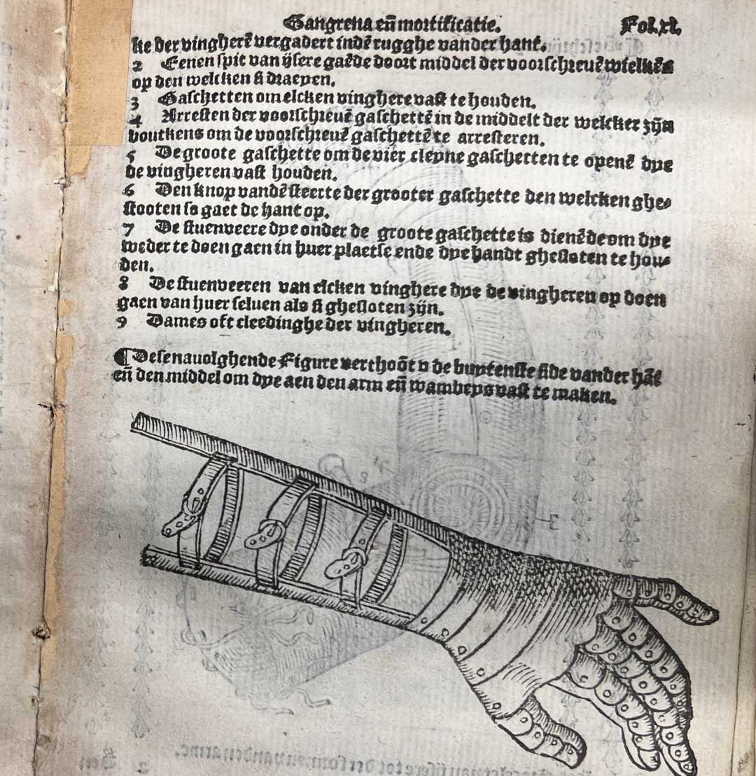 Eine Seite aus der niederländischen Ausgabe von Ambroise Parés Abhandlung über die Behandlung von Verwundungen durch Feuerwaffen und Schießpulver". Abgebildet ist eine Armprotese.