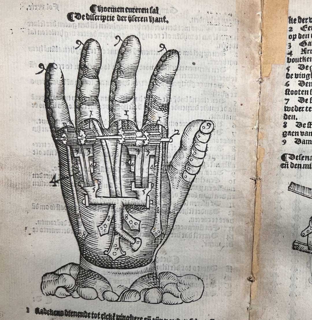 Eine Seite aus der niederländischen Ausgabe von Ambroise Parés Abhandlung über die Behandlung von Verwundungen durch Feuerwaffen und Schießpulver". Abgebildet ist eine Handprotese.